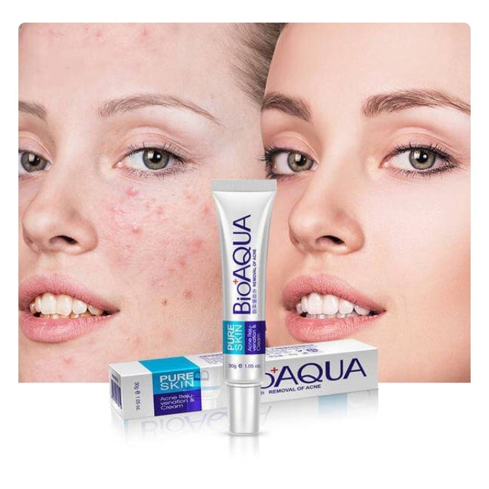 BIOAQUA - Acne Removing and Rejuvenating Cream