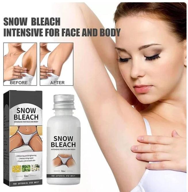 Dark spot Remover Cream