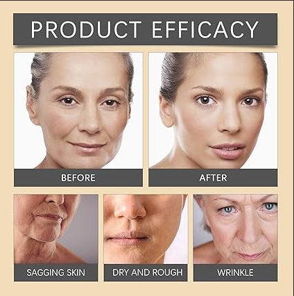 Bee Venom Botox Wrinkle Cream